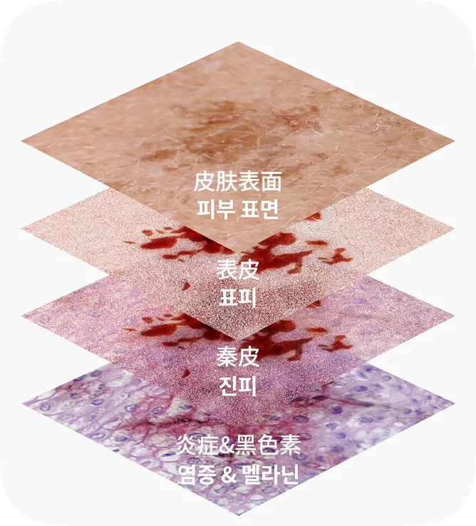 肌肤各层色素分布